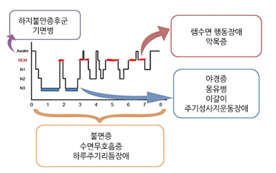 수면단계와 증상들