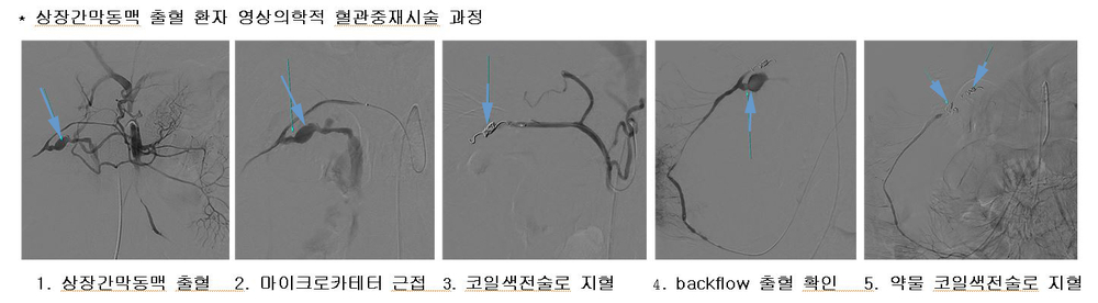 영상의학과적 혈관중재시술 과정